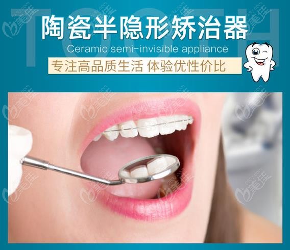 淮安陶瓷半隱形矯治器的費(fèi)用