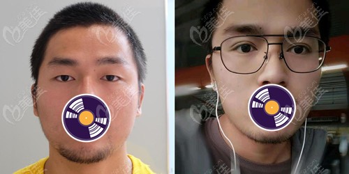 南昌时光眼综合效果图 南昌时光眼综合效果图