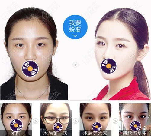 <!--<i data=20240703-sp></li>
                        </a>
                       </ul>
                    </div>
                                        <p>不管是南昌当地的小伙伴,还是外地的,都有关心南昌眼综合哪家做得好以及价格的人,小编在整理过程中发现了3家整形机构,眼综合不仅做的效果好,而且价格都挺适中的,适合普罗大众。</p>
                        <div class=