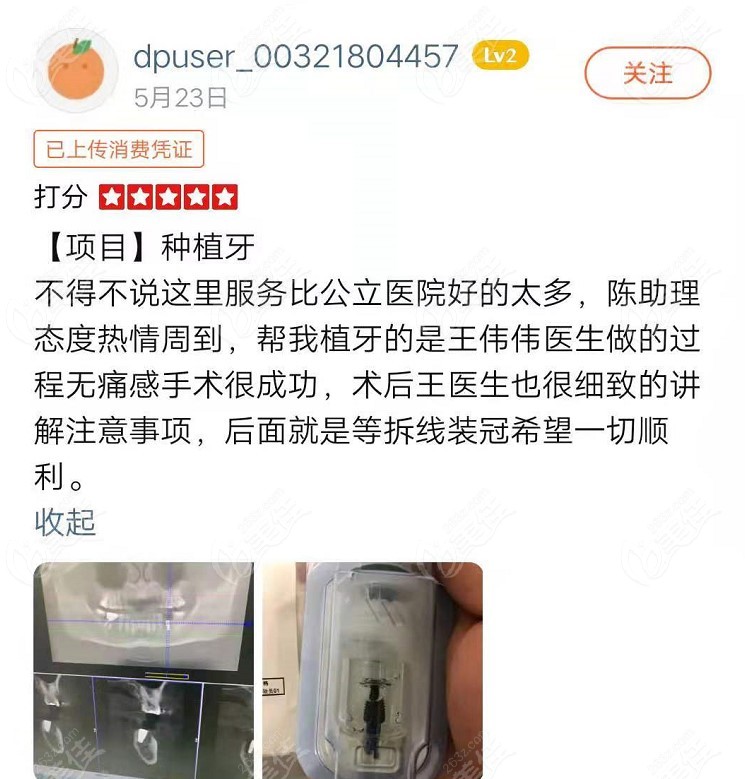 这有顾客对摩尔口腔做种植牙怎么样的评价