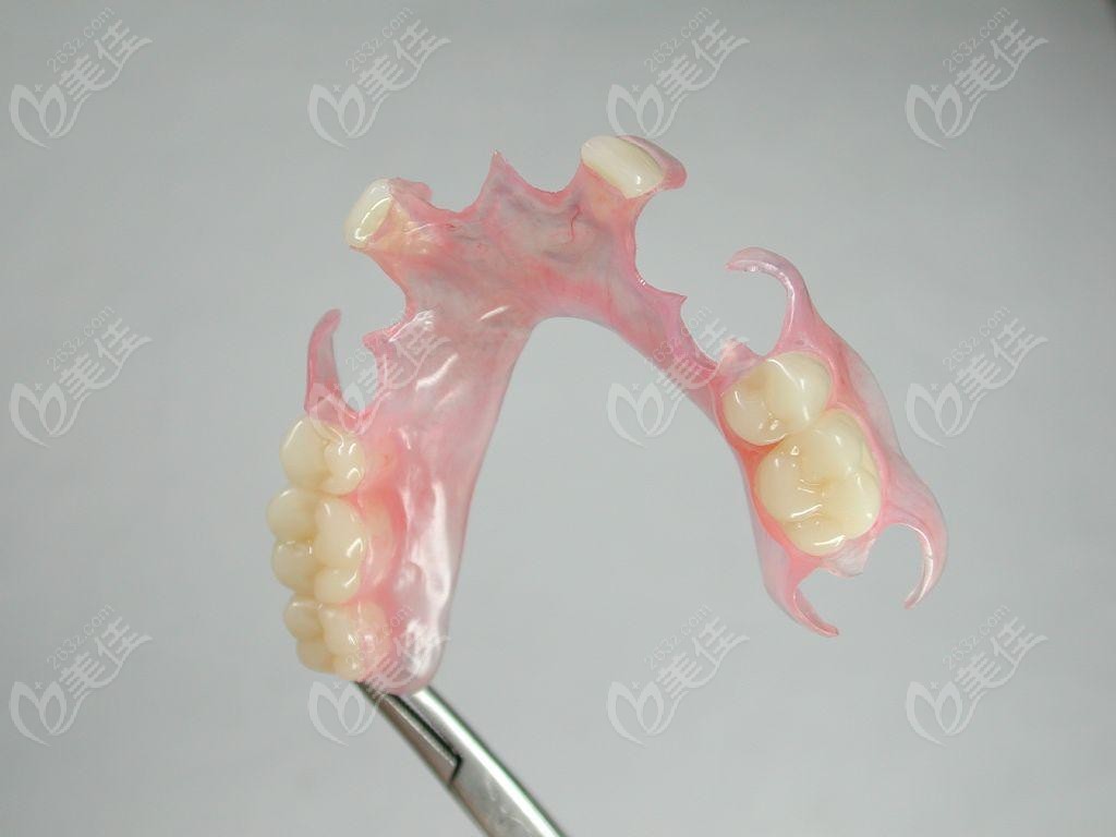 听说目前伤害较小的是活动假牙我40岁牙齿掉了难道镶一口假牙吗