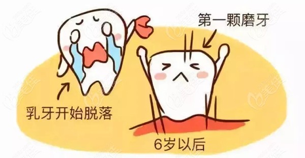 罗慕儿童矫正器和MRC适应年龄不同