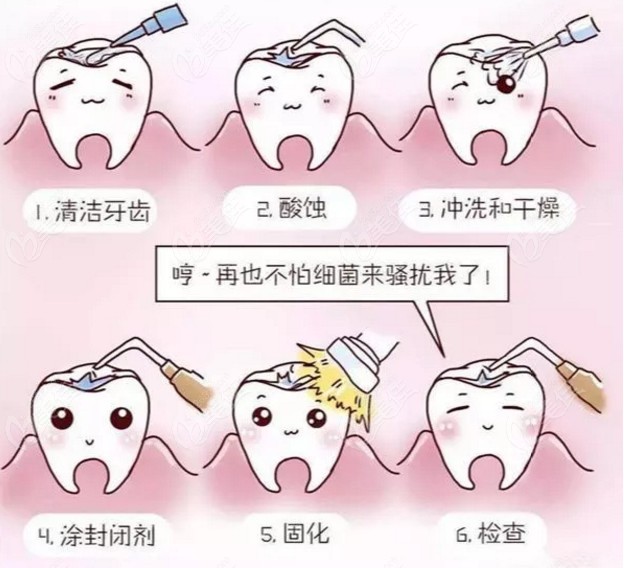 六齡齒做窩溝封閉的好處太多啦抓住成都青苗口腔世豪店免費做的機會吧