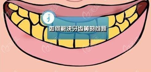 牙黄是一件比较尴尬的事