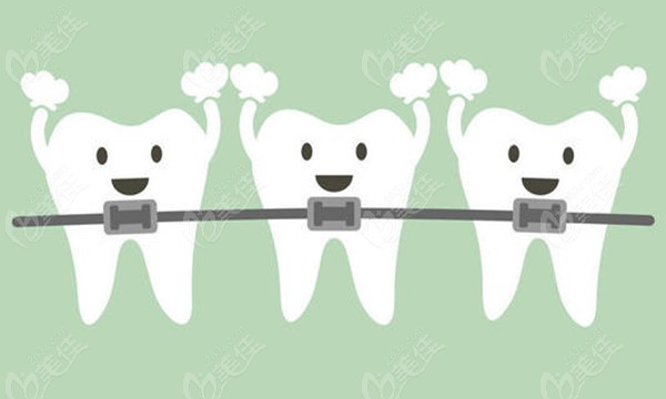 牙齿矫正有哪几种方式