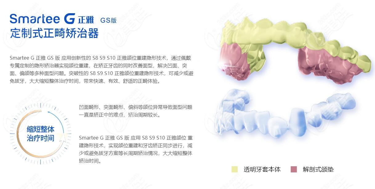 正雅隐形矫正s8