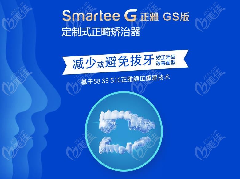 正雅GS版和GE经典版在技术优势上的区别