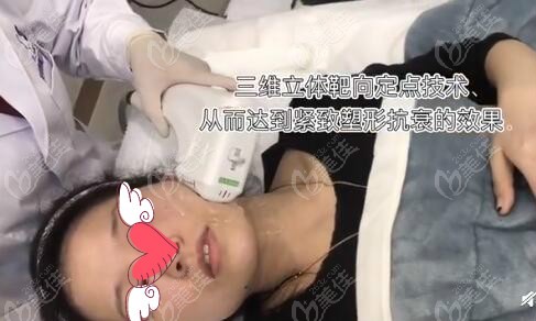 亲身体验波立塑脸部提升过程中