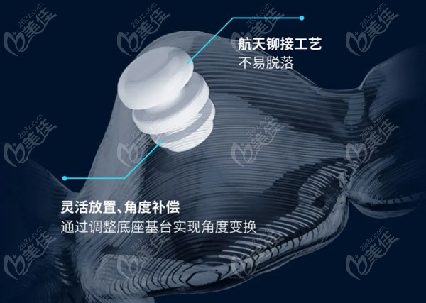 采用了航天铆接工艺不易脱落