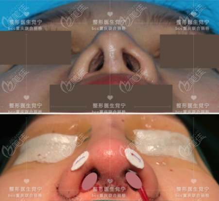 重庆联合丽格宁式生态鼻修复效果图
