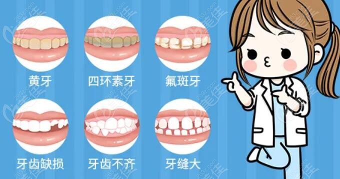 牙齿常见的缺陷问题
