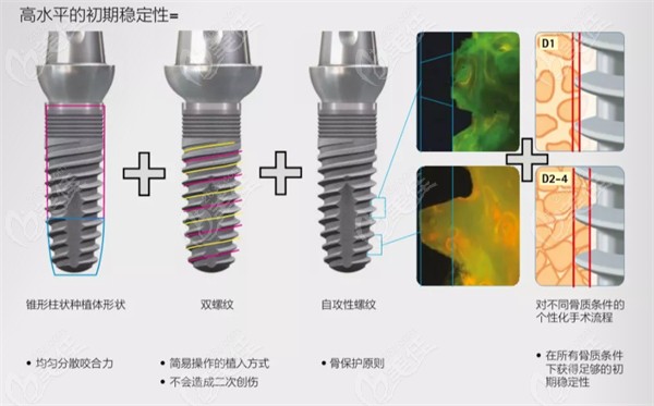 德国SKY种植体初期稳定性强