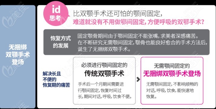 无捆绑双鄂手术和传统双鄂手术对比的区别