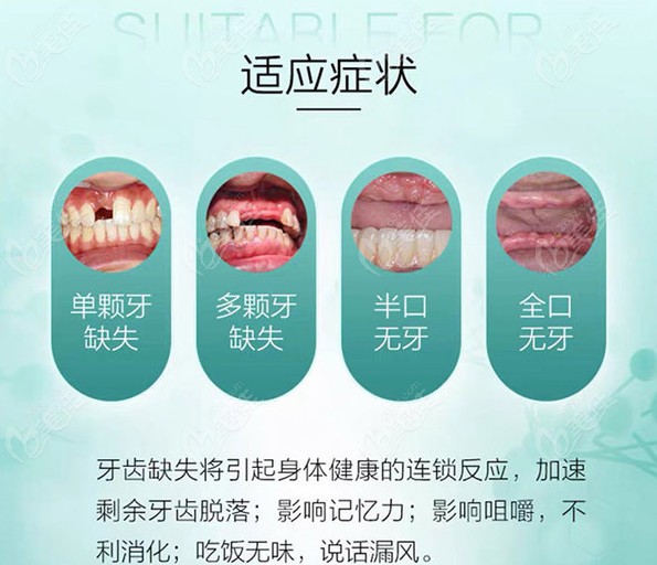 种植牙及义齿修复适应症有哪些