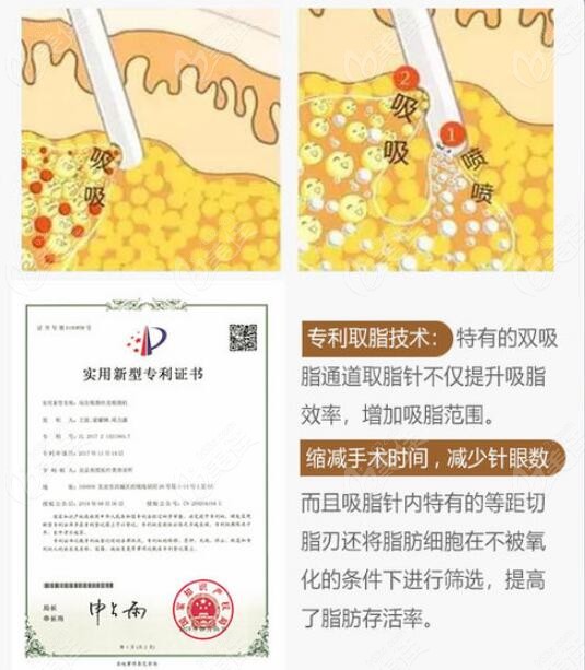 北京英煌醫(yī)院脂肪豐胸技術(shù)優(yōu)勢 北京英煌醫(yī)院脂肪豐胸技術(shù)優(yōu)勢