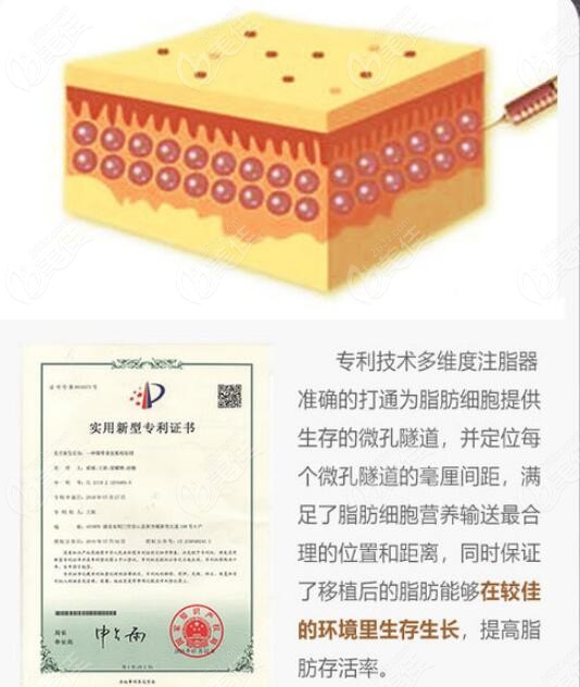 北京英煌醫(yī)院脂肪豐胸注射技術(shù)優(yōu)勢 北京英煌醫(yī)院脂肪豐胸注射技術(shù)優(yōu)勢