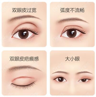 在大连星妍医疗美容做眼修复<span style=