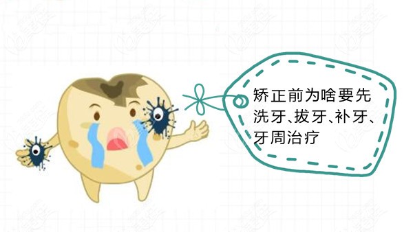 牙齿矫正前必须要洗牙、拔牙、补牙、做牙周治疗吗