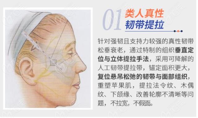 北京苏亚刘宇院长做脸部提升技术优势