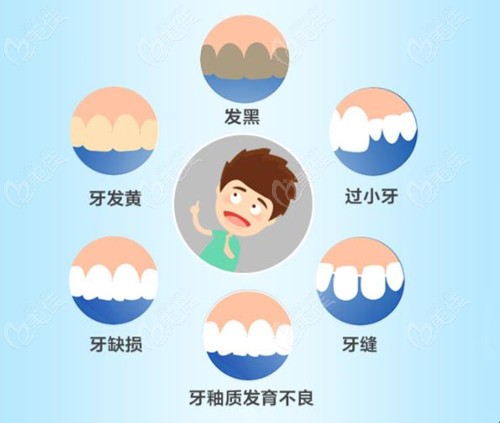 適合做美學修復的牙齒情況