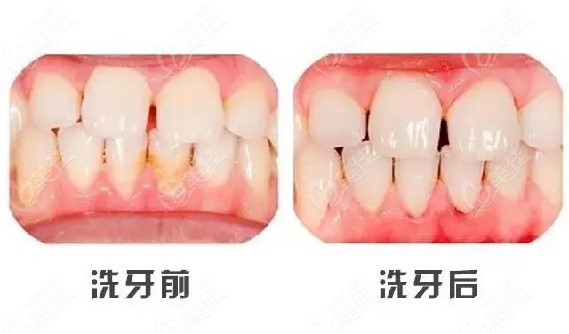 宁夏和仁堂连锁口腔洗牙/补牙/拔牙收费标准