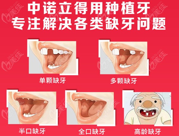 中诺口腔的立得用种植牙技术