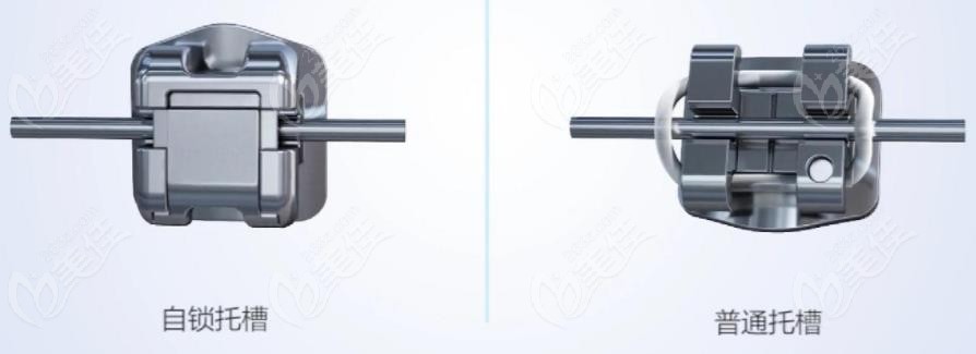 自锁托槽的锁扣和非自锁对比
