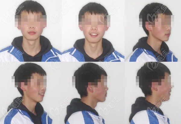  患者治療后面相