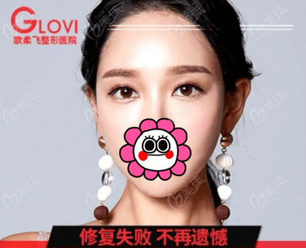 韩国歌柔飞整形不仅做切开双眼皮修复比较好,且即日起做手术有优惠