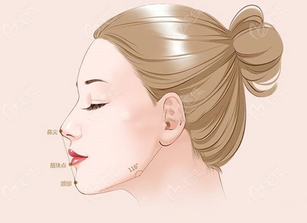 做正頜手術還是正畸治療，醫(yī)生都會要求先拍片