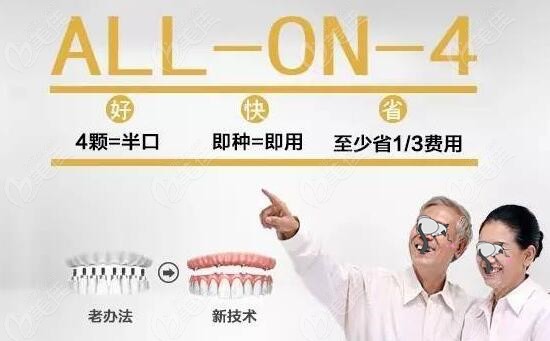 合肥做半口/全口all-on-4种植牙的价格