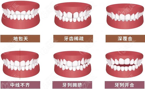 想知道绍兴京韩口腔医院做牙齿矫正多少钱吗？整牙价格就在文中