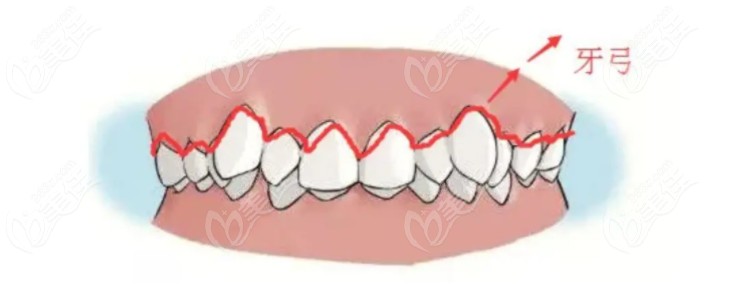正常牙弓图片