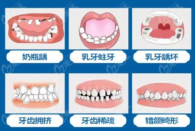儿童有以下牙齿问题都可以报名