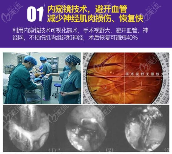 合肥韓美磨骨手術在內(nèi)窺鏡下操作的