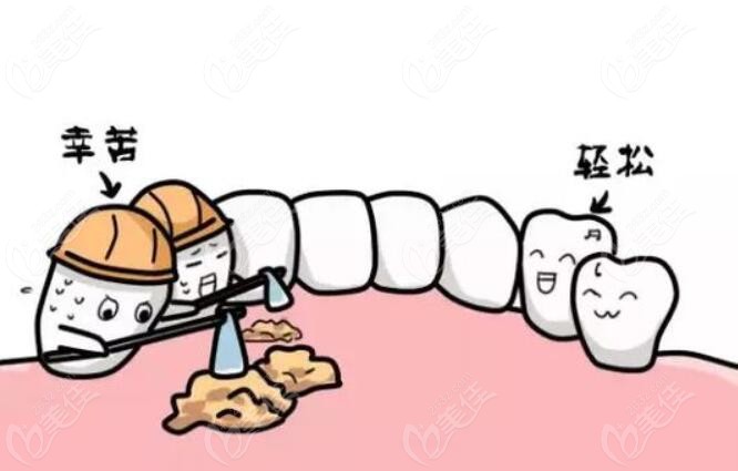 前牙种植修复