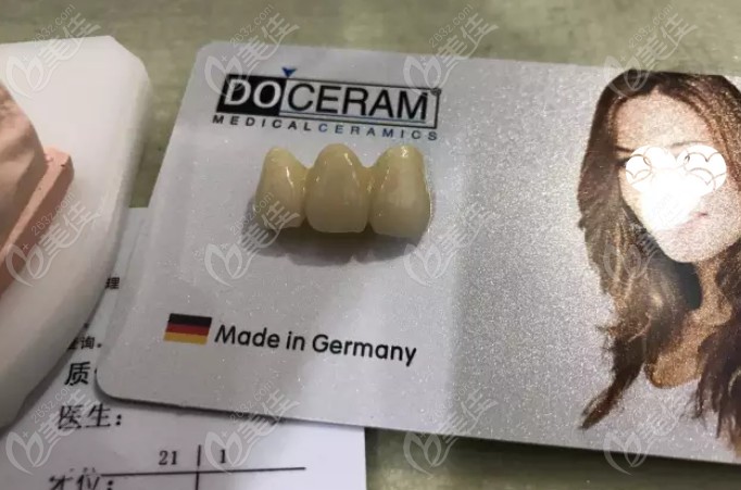 德国杜塞拉姆全瓷牙的包装及防伪查询卡