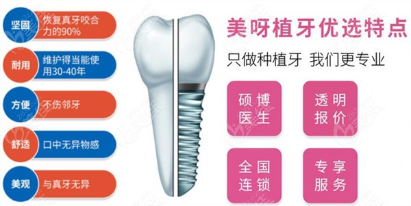 北京美呀植牙口腔种植牙优势