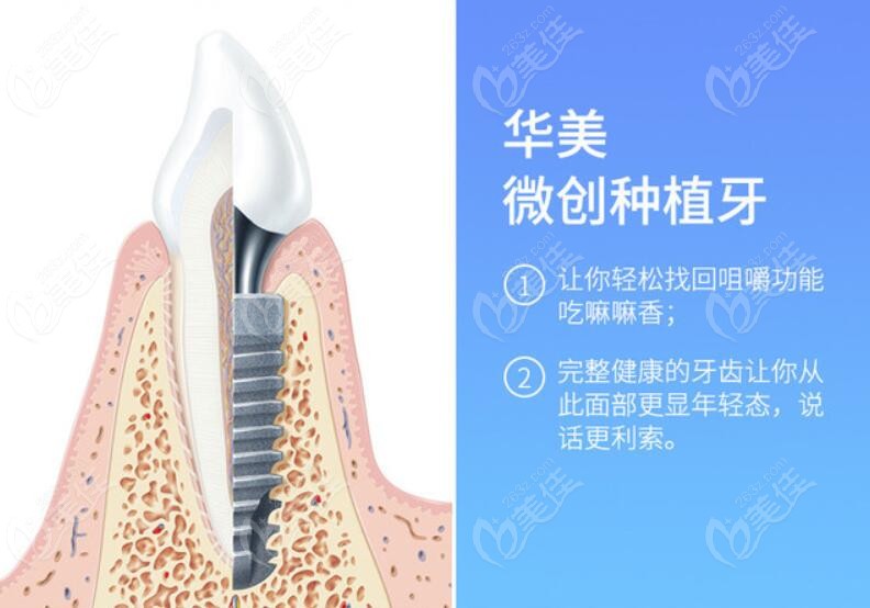 南京华美口腔的微创种植牙技术