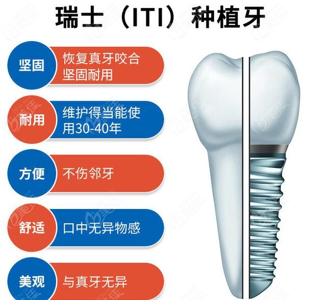 北京做一颗瑞士ITI种植牙的全套价格才8980元起,还有硕博医生亲诊哦活动海报五