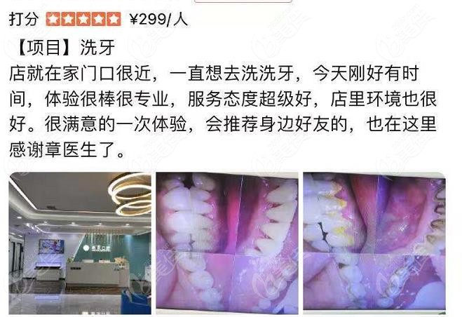 洗牙顾客对于皓亚的评价