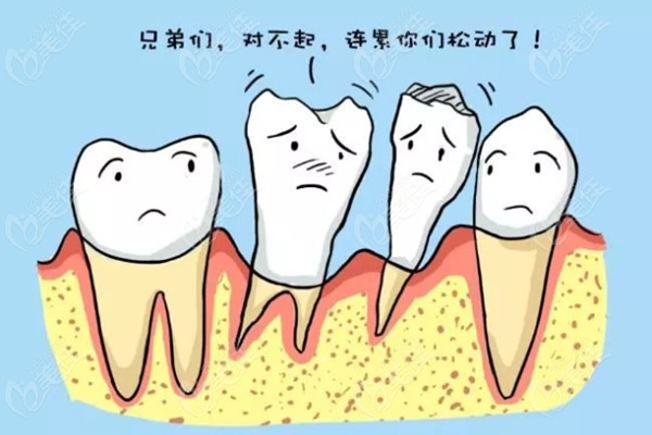 导致牙齿松动的原因