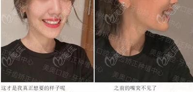 矫正完前后对比图