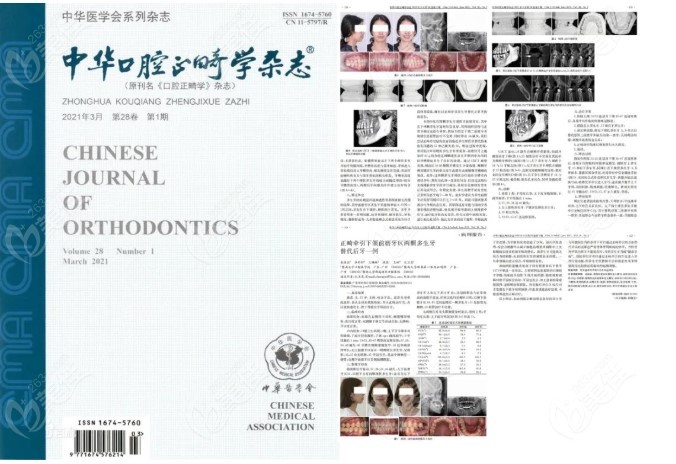 广州穗华口腔医院正畸科临床诊疗成果登上《中国口腔正畸学杂志》