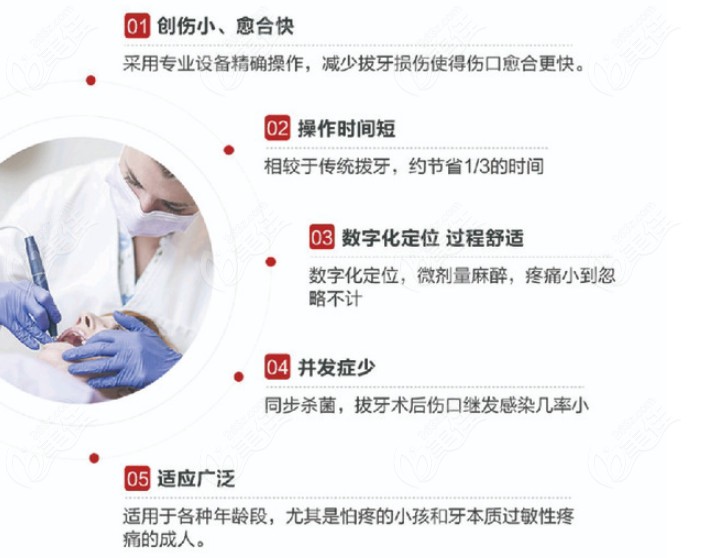 麦格口腔超生骨刀拔牙的优势