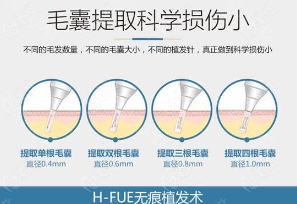 保定植发机构有哪几家