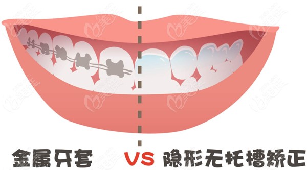 绍兴整牙一般要多少钱
