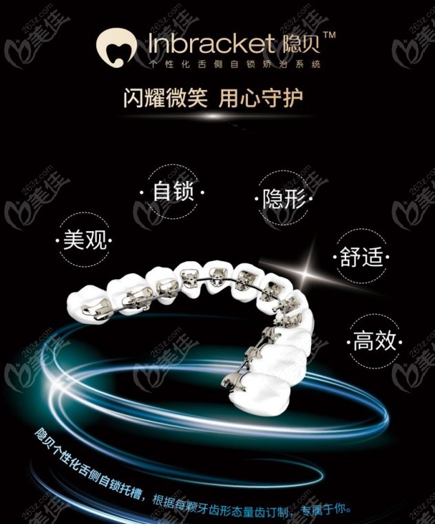 隐贝舌侧自锁托槽的的介绍