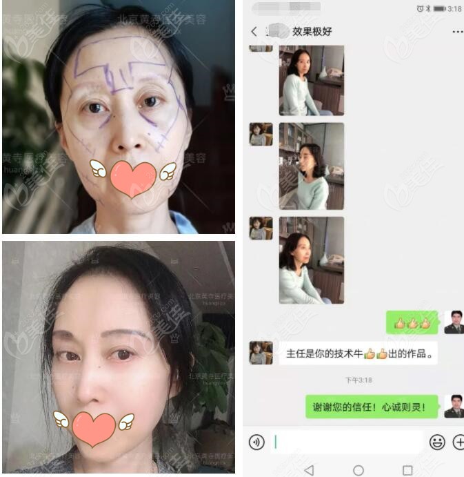 北京黄寺的大拉皮真人实例