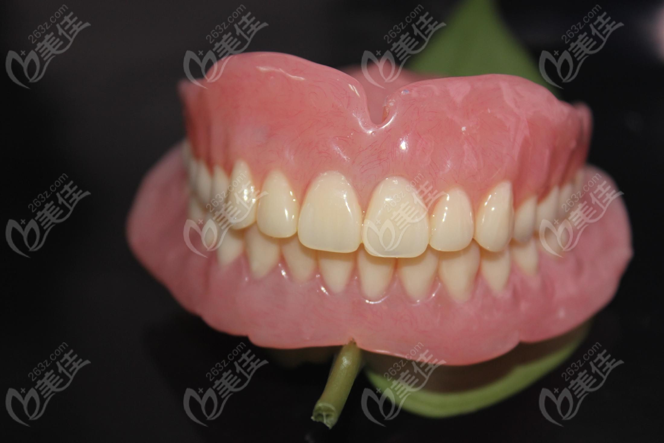 bps吸附性义齿图片